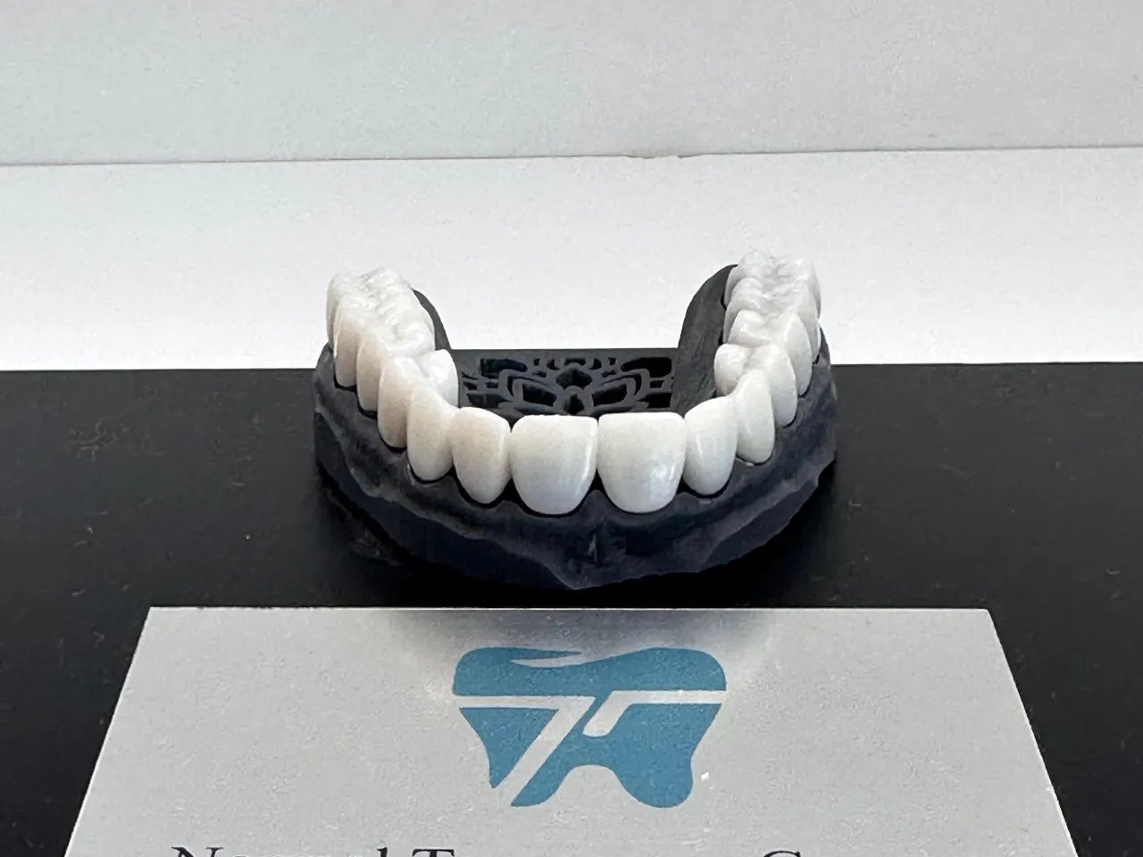 Temporary Crowns