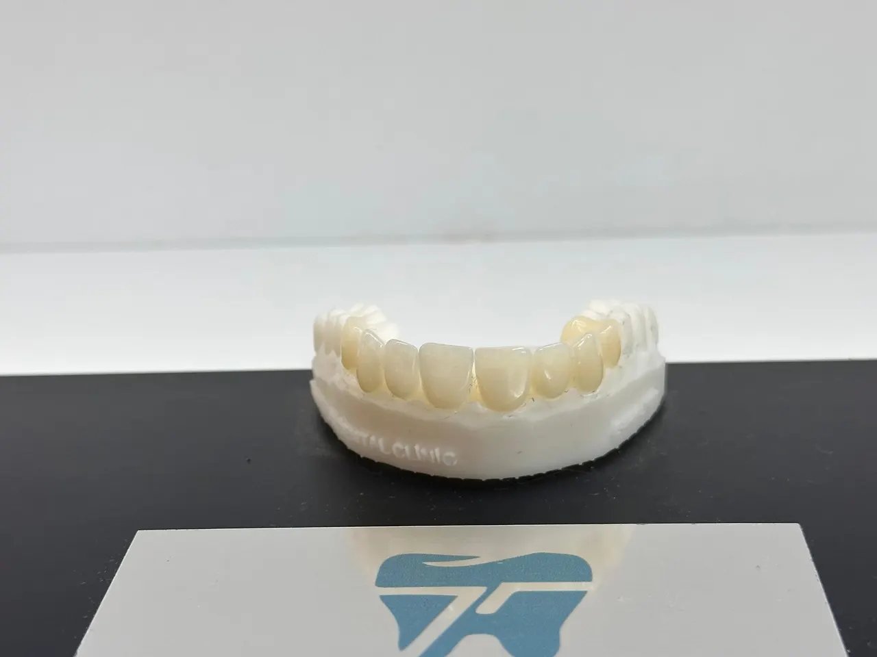 E-Max Veneers