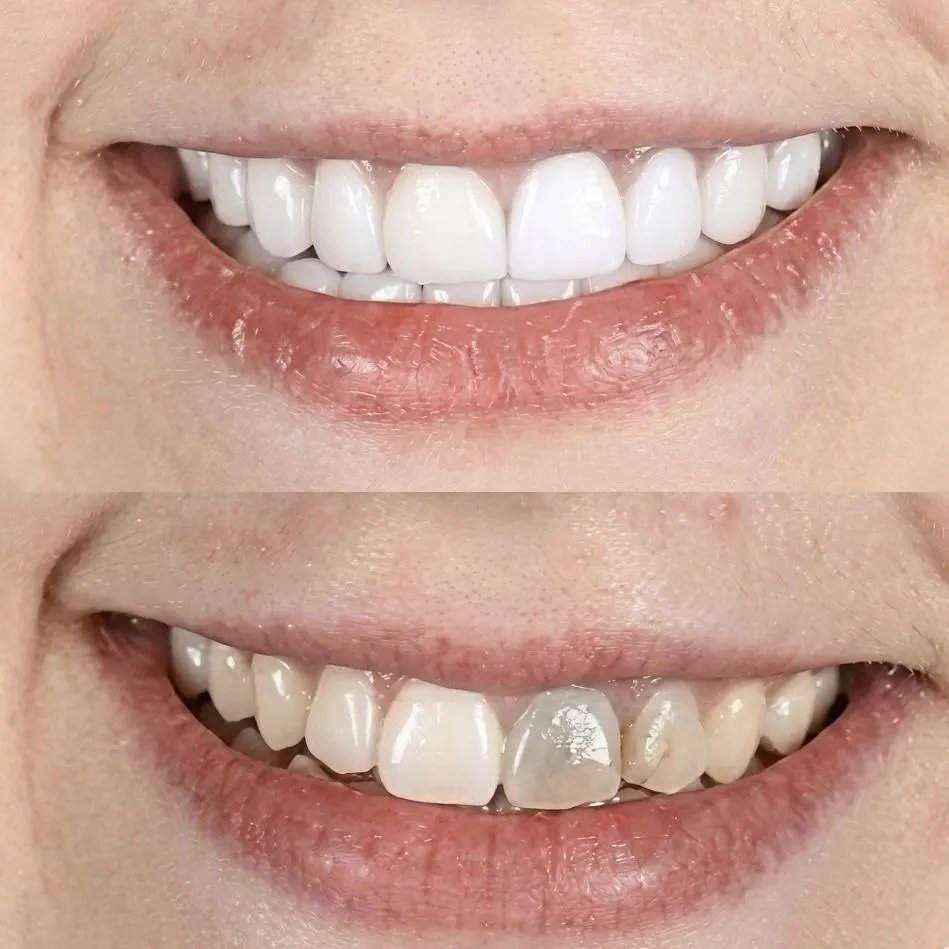 The Story of a Renewed Smile at Tantalya