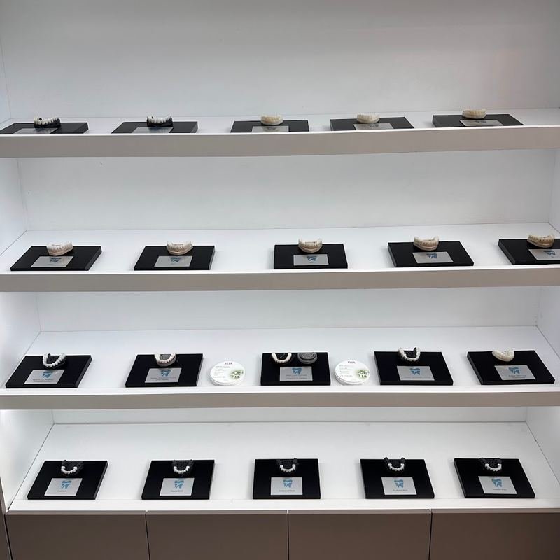 The shade and style library at Tantalya Dental Clinic — a lit wall of zirconia and E.max full-arch samples