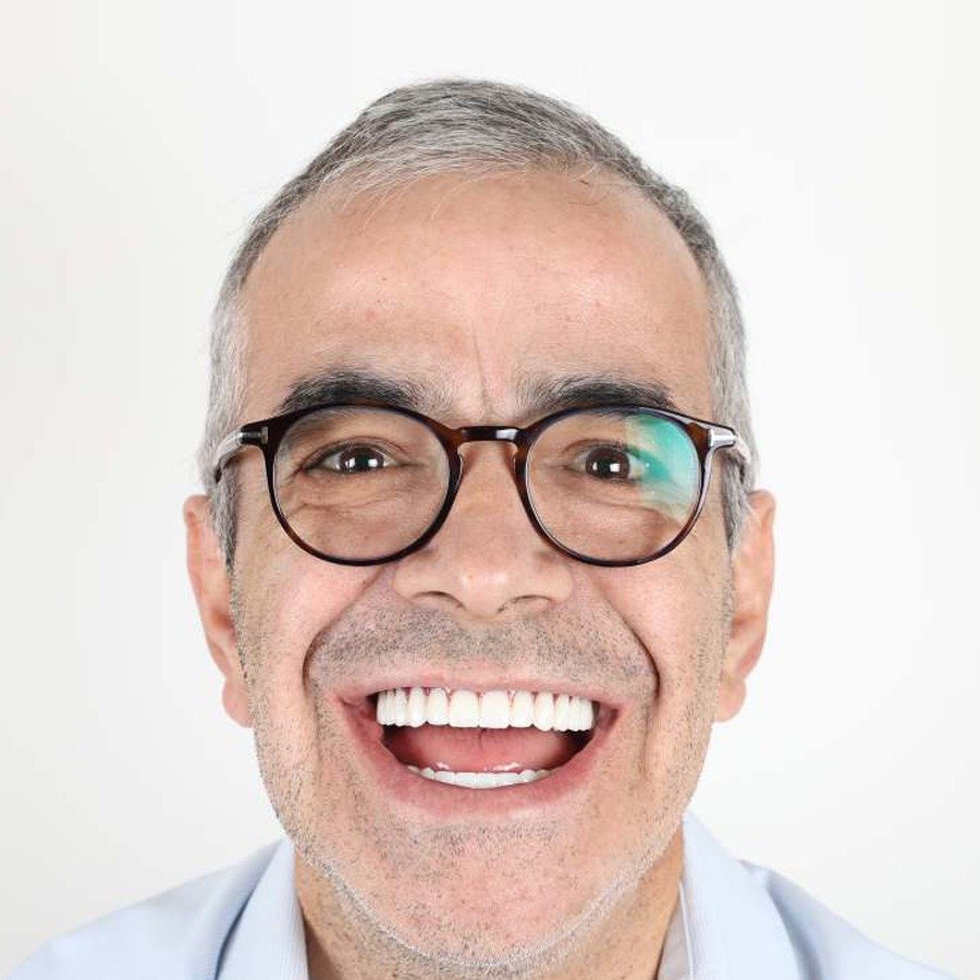 Smile makeover — After