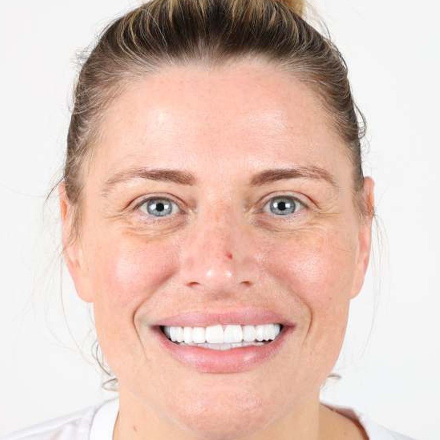 Smile makeover — After