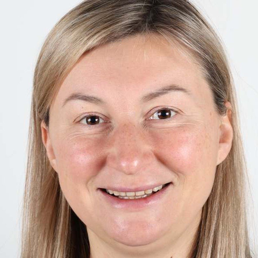 Smile makeover — Before
