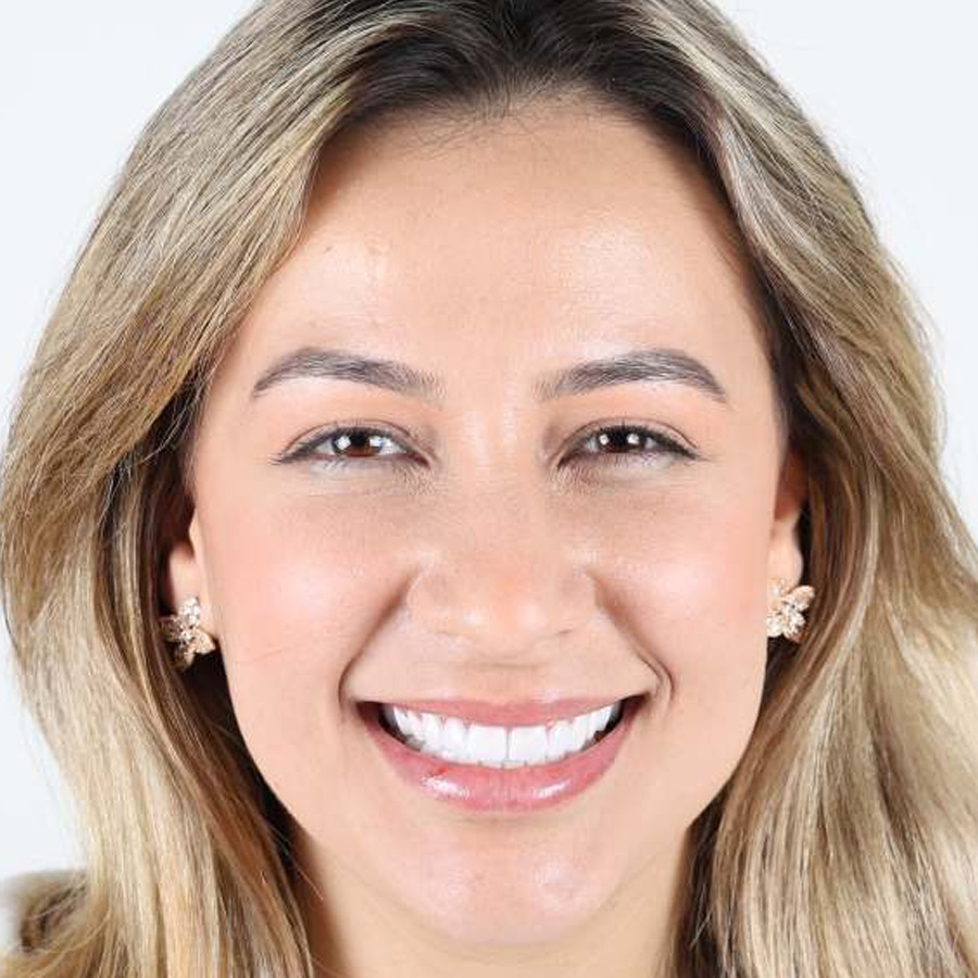 Smile makeover — After