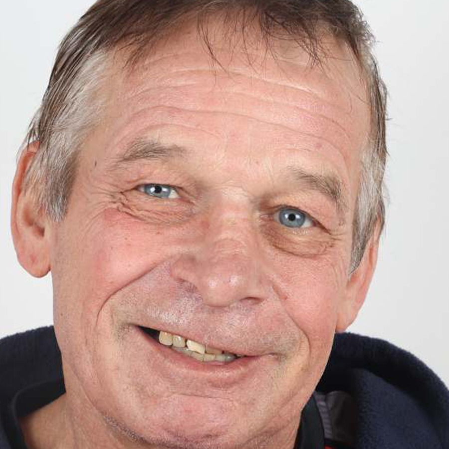 Smile makeover — Before