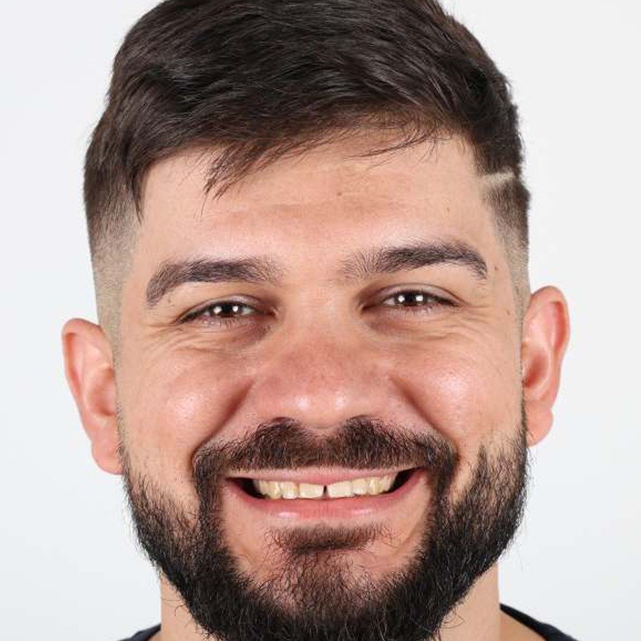 Smile makeover — Before